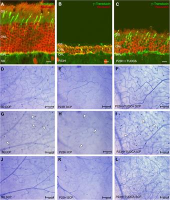 Neuroprotective Effects of Tauroursodeoxicholic Acid Involves Vascular and Glial Changes in Retinitis Pigmentosa Model